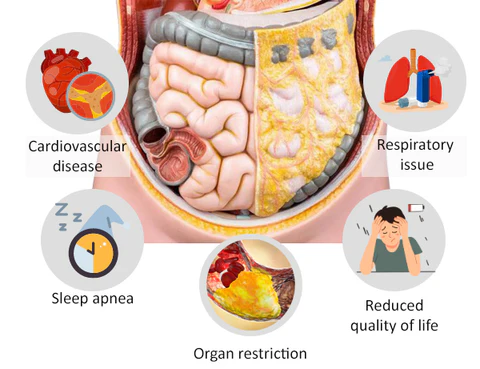 Healthify™ Visceral Fat Treatment Drops 