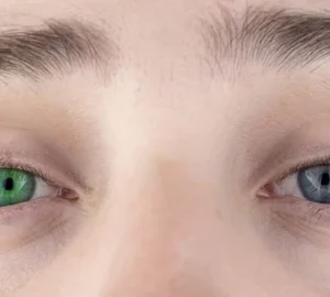 Zakdavi™ IrisInk PRO Eye Drops