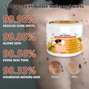 Lenaro™ Bee Venom Mole and Wart Treatment Cream