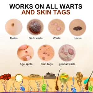 Lenaro™ Bee Venom Mole and Wart Treatment Cream