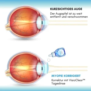 VisioClear™ Flüssige Tageslinse