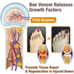 flysmus™ HalluxCare Bee Venom Treatment Cream