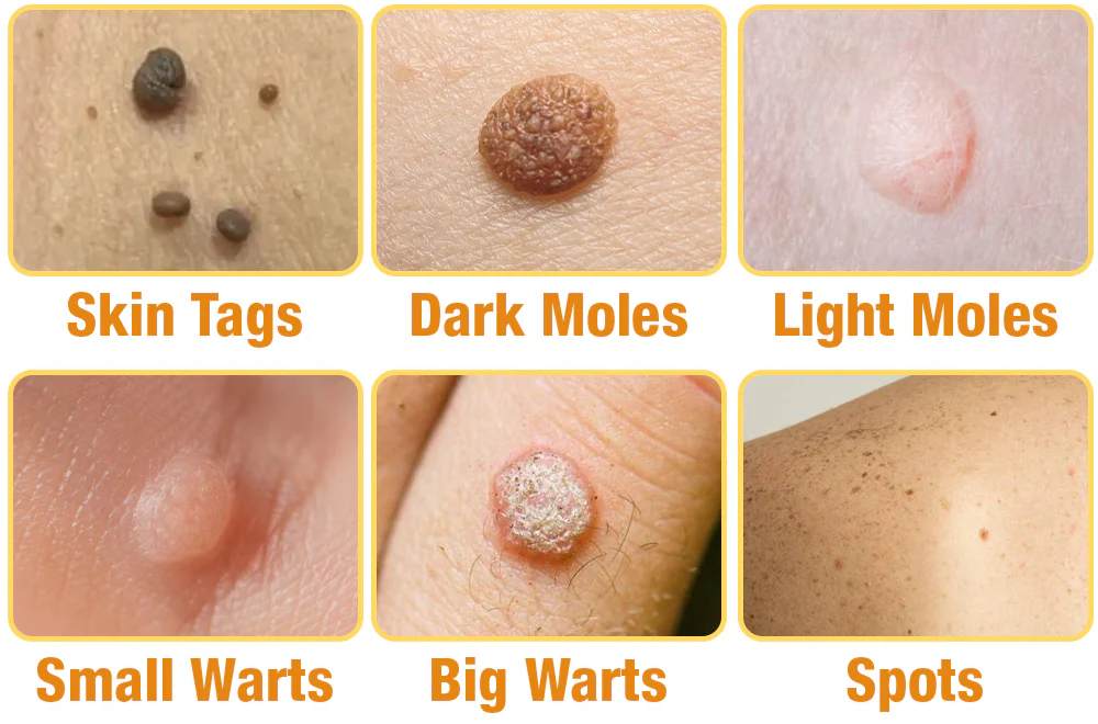 flysmus™ TagRecede Bee Venom Treatment Spray