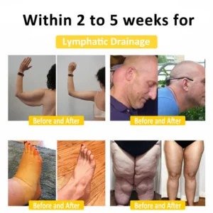 AAFQ™ Bee Venom Lymphatic Drainage Slimming Soap