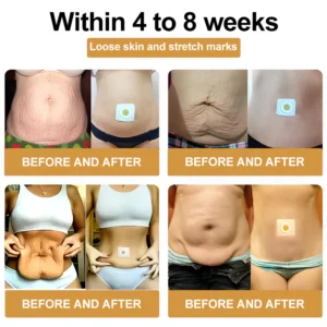BeVlix™ 𝐁𝐞𝐞 𝐕𝐞𝐧𝐨𝐦 𝐋𝐲𝐦𝐩𝐡𝐚𝐭𝐢𝐜 𝐃𝐫𝐚𝐢𝐧𝐚𝐠𝐞 𝐒𝐥𝐢𝐦𝐦𝐢𝐧𝐠 𝐏𝐚𝐭𝐜𝐡