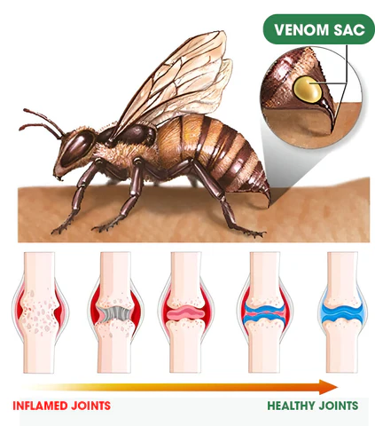 Bee Venom Joint and Bone Therapy Advanced Cream