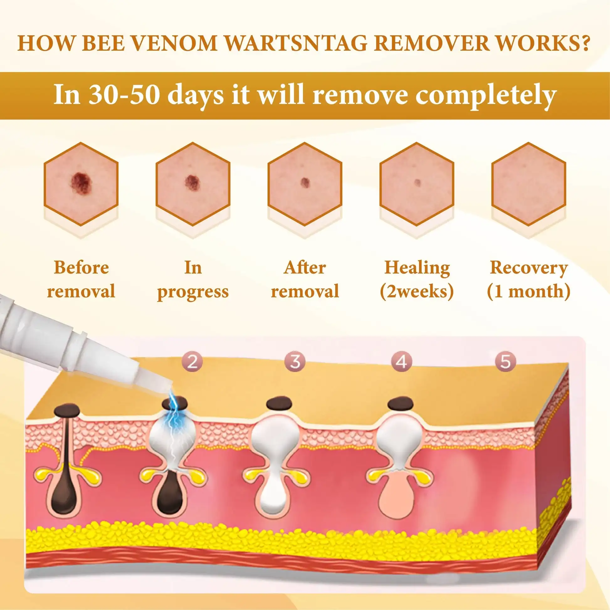 Bee Venom WartsNTag SmoothClear Remover