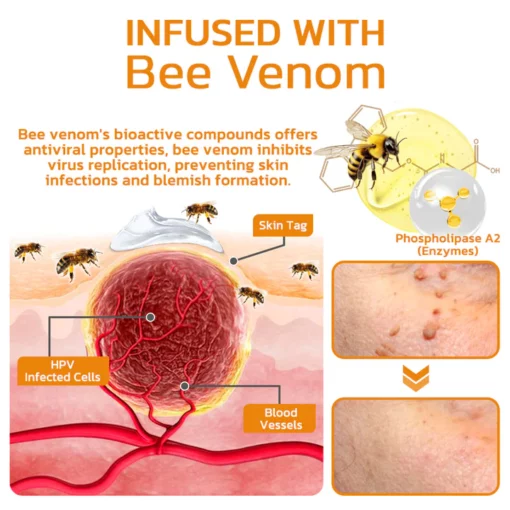 BeeGuard™ Bee Venom Mole and Wart Treatment Cream