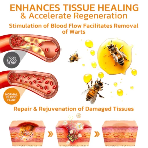 BeeGuard™ Bee Venom Mole and Wart Treatment Cream