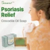 Biancat™ Psoriasis Relief Crocodile Oil Soap