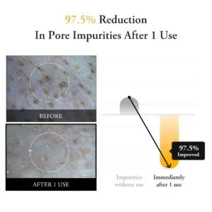 Calendula Peel Off Pack