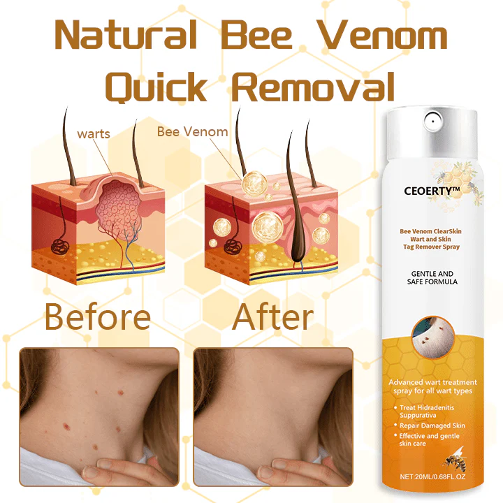 Ceoerty™ Bee Venom ClearSkin Wart and Skin Tag Remover Spray