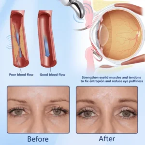 Ceoerty™ BrightLift Electric Eye Firming Cream