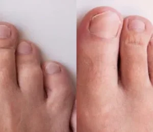 Ceoerty™ Rapid Nail Growth and Fortifying Serum