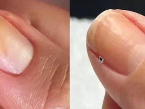 Ceoerty™ Rapid Nail Growth and Fortifying Serum