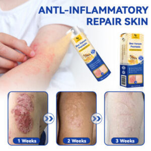 CroAie™ PsoriaHeal Bee Venom Psoriasis Treatment Spray plus