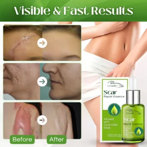 Croufix™ Scar Repair Essence