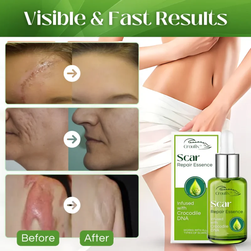 Croufix™ Scar Repair Essence