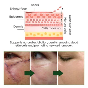 Croufix™ Scar Repair Essence