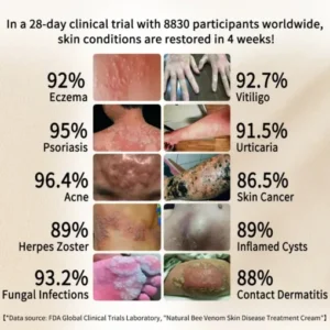 Cvreoz™ Natural Bee Venom Skin Disease Treatment Cream