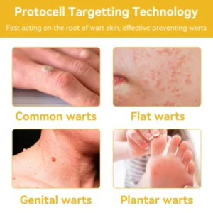 DOCTIA™ Bee Venom Medical Grade Scar Remove Advanced Gel