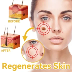 DOCTIA™ Bee Venom Medical Grade Scar Remove Advanced Gel