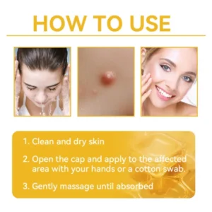 DOCTIA™ Bee Venom Medical Grade Scar Remove Advanced Gel