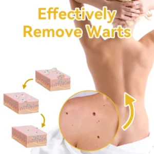 DOCTIA™ Bee Venom Medical Grade Scar Remove Advanced Gel
