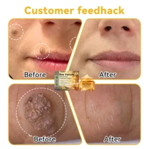 DOCTIA™ Bee Venom Medical Grade Scar Remove Advanced Gel