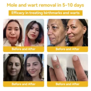 DOCTIA™ Bee Venom Medical Grade Scar Remove Advanced Gel