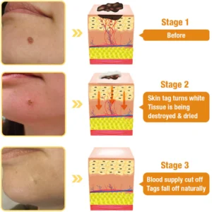Dobshow™ Bee Venom Miracle Spray Naturally Remove Skin Tags & Warts1.webp Dobshow™ Bee Venom Miracle Spray Naturally Remove Skin Tags & Warts12.webp Dobshow™ Bee Venom Miracle Spray Naturally Remove Skin Tags & Warts13.webp Dobshow™ Bee Venom Miracle Spray Naturally Remove Skin Tags & Warts14.webp Dobshow™ Bee Venom Miracle Spray Naturally Remove Skin Tags & Warts15.webp
