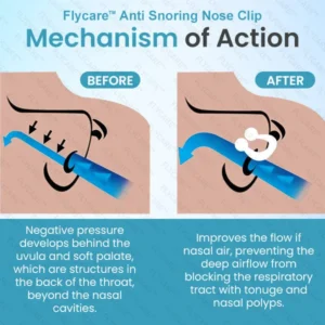FLYCARE™ Anti Snoring Nose Clip