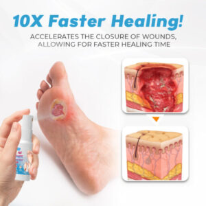 FLYCARE™ Fast Diabetic Wounds Healing Spray