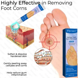 FLYCARE™ Herbal Foot Corn Removal Ointment