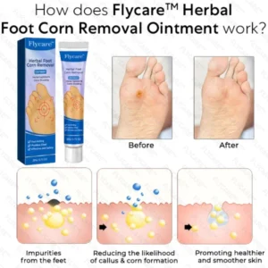 FLYCARE™ Herbal Foot Corn Removal Ointment