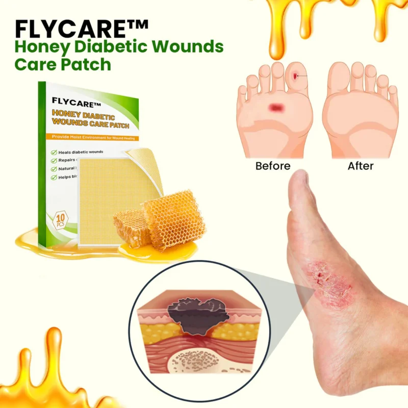 FLYCARE™ Honey Diabetic Wounds Care Patch