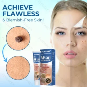 FLYCARE™ Wart Removal Oitment