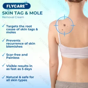 FLYCARE™ Wart Removal Oitment