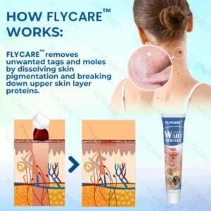 FLYCARE™ Wart Removal Oitment