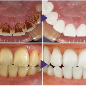 Fivfivgo™ Gum Therapy Gel - Upgraded formula for superior cleansing and repair