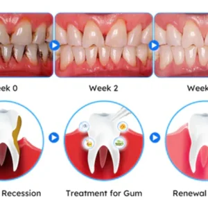 Fivfivgo™ Gum Therapy Gel - Upgraded formula for superior cleansing and repair