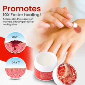 Flycare™ Fast Healing Diabetic Wound Ointment