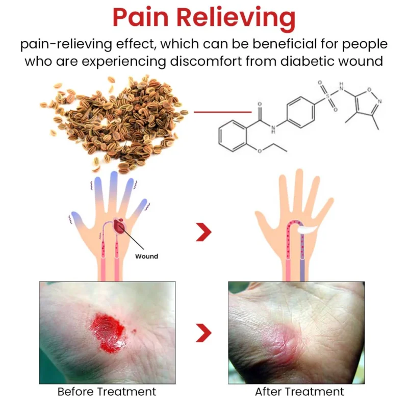 Flycare™ Fast Healing Diabetic Wound Ointment