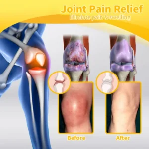 Furzero™ Bee Venom Advanced Joint and Bone Therapy Cream