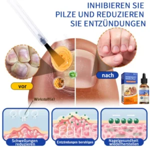 Furzero™ Bienengift Nagelpilz Behandlungslösung