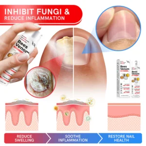 Furzero™ Multi-Symptom Bee Venom Psoriasis Treatment Spray