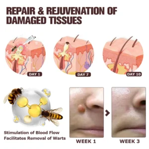 Furzero™ TagFree And Moles Remover