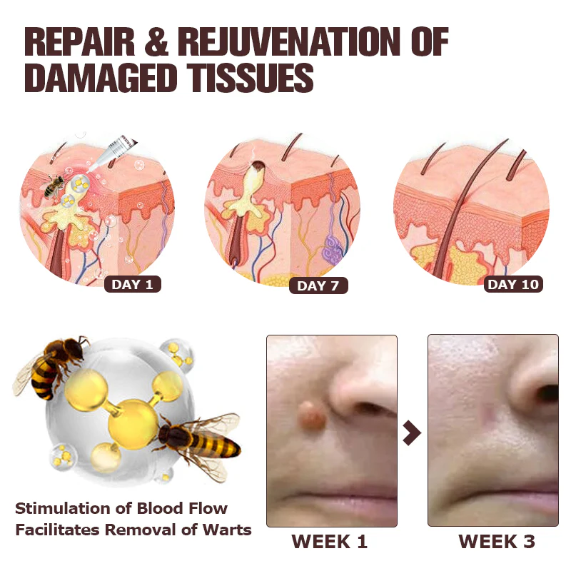 Furzero™ TagFree And Moles Remover