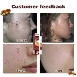 Furzero™ TagFree And Moles Remover