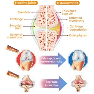 Furzero™ Turmeric Arthritis Cream
